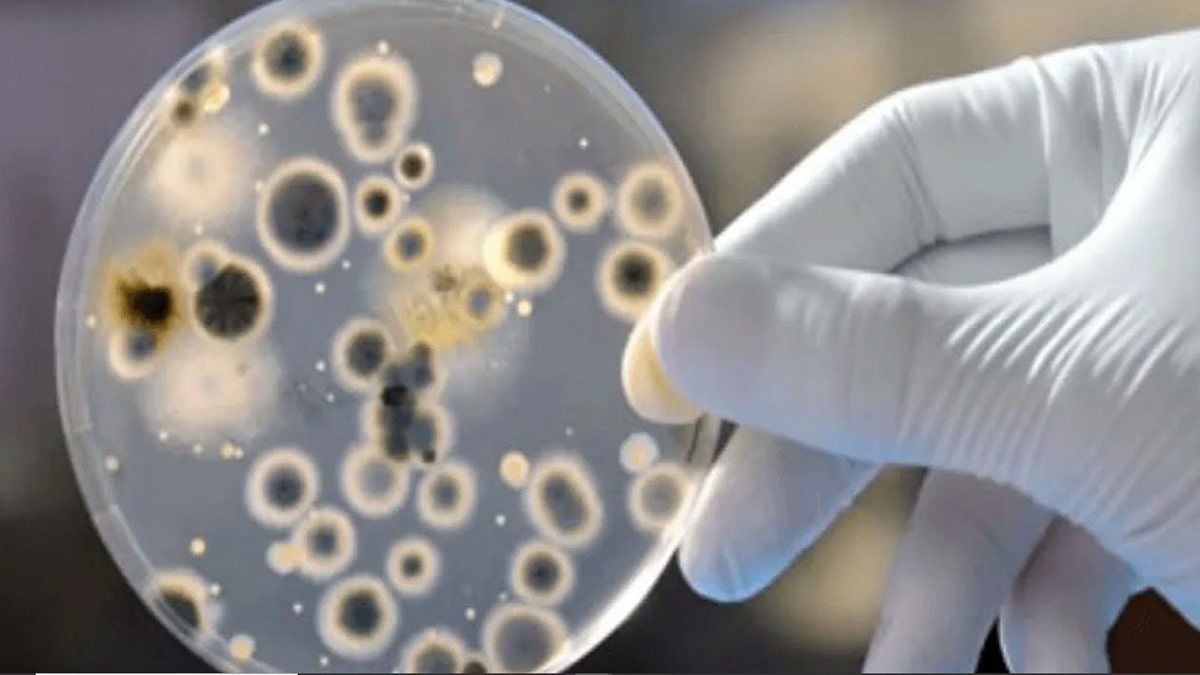 Superbug Fungus Candida Auris Untreatable infections spreading in